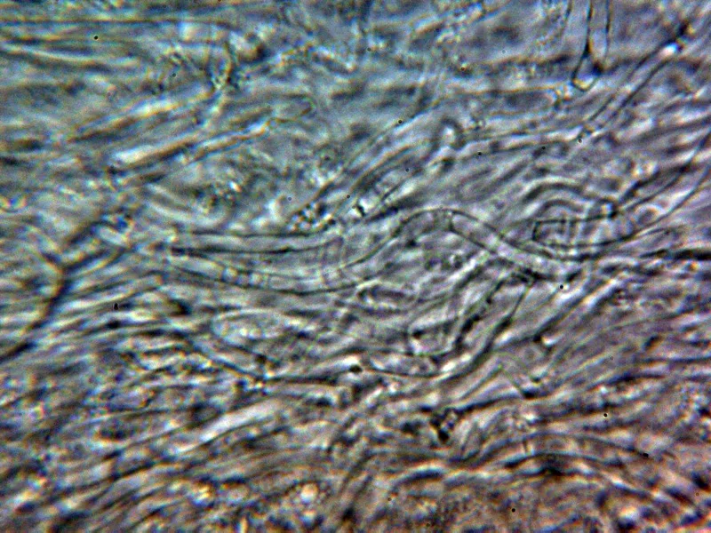 Amanita vaginata 10 - Subpellis agua 1
